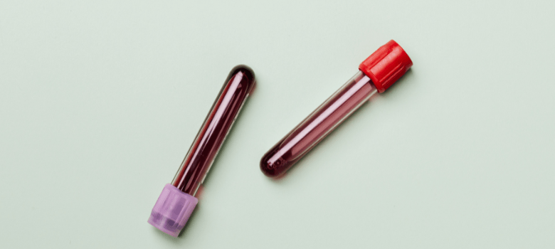 Nieuwe priklocatie DIAMID in Gezondheidshuis